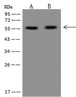 PPP2R5A Polyclonal Antibody