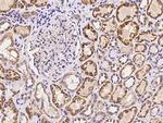 PPP2R5E Polyclonal Antibody