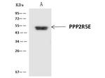 PPP2R5E Antibody in Immunoprecipitation (IP)