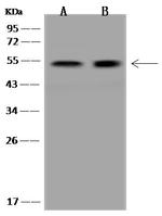 PPP2R5E Antibody in Western Blot (WB)