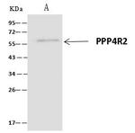 PPP4R2 Antibody in Immunoprecipitation (IP)