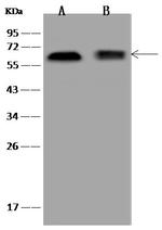 PPP4R2 Antibody in Western Blot (WB)