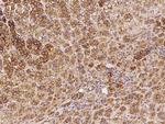 PRKAR2B Polyclonal Antibody