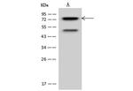 PKC delta Polyclonal Antibody