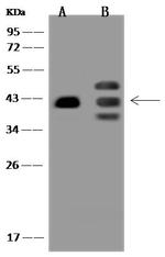 PRPF18 Polyclonal Antibody