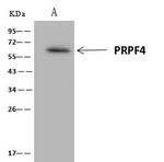 PRPF4 Antibody in Immunoprecipitation (IP)
