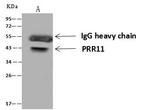 PRR11 Antibody in Immunoprecipitation (IP)