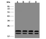 Presenilin 1 Polyclonal Antibody