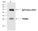 PSMB1 Antibody in Immunoprecipitation (IP)