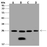 PSMB1 Antibody in Western Blot (WB)