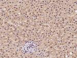 PSMB6 Antibody in Immunohistochemistry (Paraffin) (IHC (P))