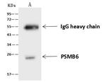 PSMB6 Antibody in Immunoprecipitation (IP)