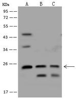 PSMB6 Antibody in Western Blot (WB)