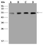 PSMC4 Polyclonal Antibody