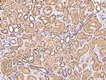 PSMD4 Antibody in Immunohistochemistry (Paraffin) (IHC (P))