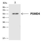 PSMD4 Antibody in Immunoprecipitation (IP)