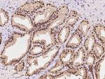 PSMD5 Antibody in Immunohistochemistry (Paraffin) (IHC (P))