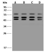 PSMD6 Polyclonal Antibody