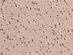 PSMD7 Antibody in Immunohistochemistry (Paraffin) (IHC (P))