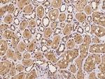 PSMD9 Polyclonal Antibody