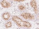 PSPC1 Antibody in Immunohistochemistry (Paraffin) (IHC (P))