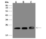 p23 Polyclonal Antibody