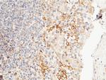 PTP1B Antibody in Immunohistochemistry (Paraffin) (IHC (P))
