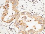PTP1B Antibody in Immunohistochemistry (Paraffin) (IHC (P))