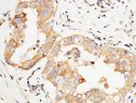 PTP1B Antibody in Immunohistochemistry (Paraffin) (IHC (P))