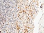 PTP1B Antibody in Immunohistochemistry (Paraffin) (IHC (P))