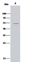 PTP1B Antibody in Immunoprecipitation (IP)