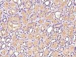 PTPN12 Polyclonal Antibody