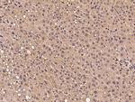 PTPN12 Antibody in Immunohistochemistry (Paraffin) (IHC (P))