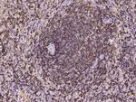 CD45 Antibody in Immunohistochemistry (Paraffin) (IHC (P))