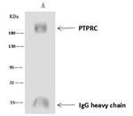 CD45 Antibody in Immunoprecipitation (IP)