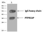 PTPRCAP Antibody in Immunoprecipitation (IP)