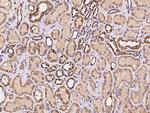 RAB18 Antibody in Immunohistochemistry (Paraffin) (IHC (P))