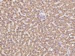 RAB18 Antibody in Immunohistochemistry (Paraffin) (IHC (P))