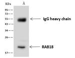 RAB18 Antibody in Immunoprecipitation (IP)