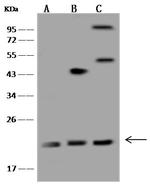 RAB18 Antibody in Western Blot (WB)