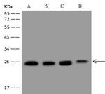 RAB1A Polyclonal Antibody
