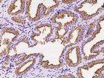 RAB27A Polyclonal Antibody