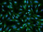 RABEP1 Polyclonal Antibody