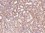 RALB Polyclonal Antibody