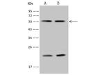 RALY Antibody in Western Blot (WB)
