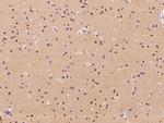 RBM17 Polyclonal Antibody