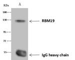 RBM19 Antibody in Immunoprecipitation (IP)