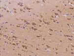 REEP2 Polyclonal Antibody