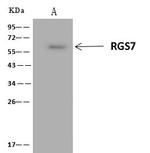 RGS7 Antibody in Immunoprecipitation (IP)