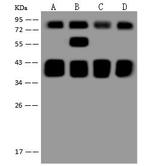 RIP1 Polyclonal Antibody